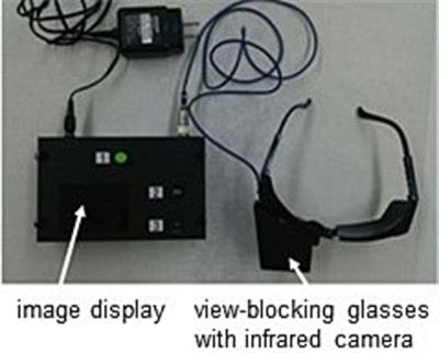 Stratification of patients with Menière’s disease based on eye movement videos recorded from the beginning of vertigo attacks and contrast-enhanced MRI findings